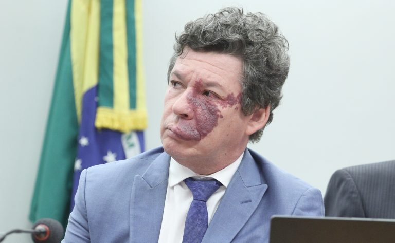 Audiência Pública - Impactos da Reforma Tributária na empregabilidade do país. Dep. Reginaldo Lopes (PT - MG)